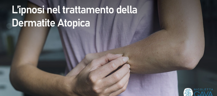 L’ipnosi nel trattamento della Dermatite Atopica